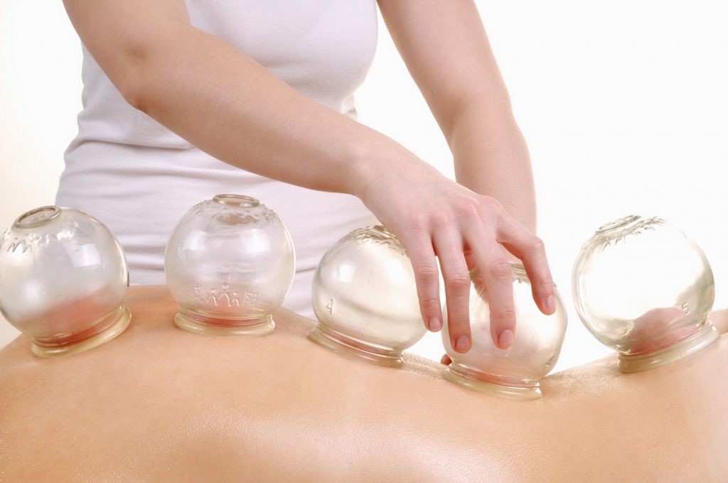 Cupping Acupuncture